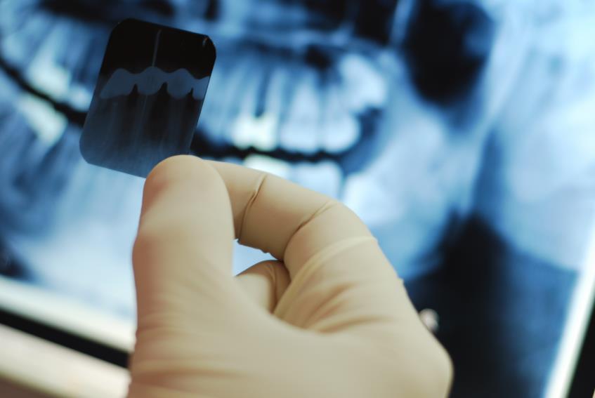 RADIOLOGIA DENTAL