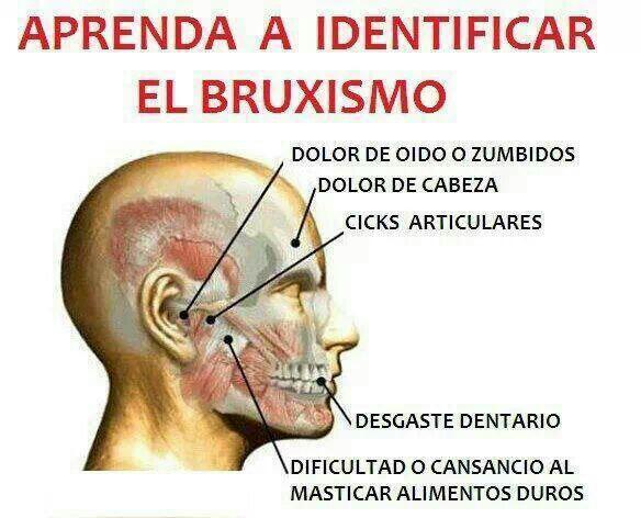 aprende a identificar el bruxismo