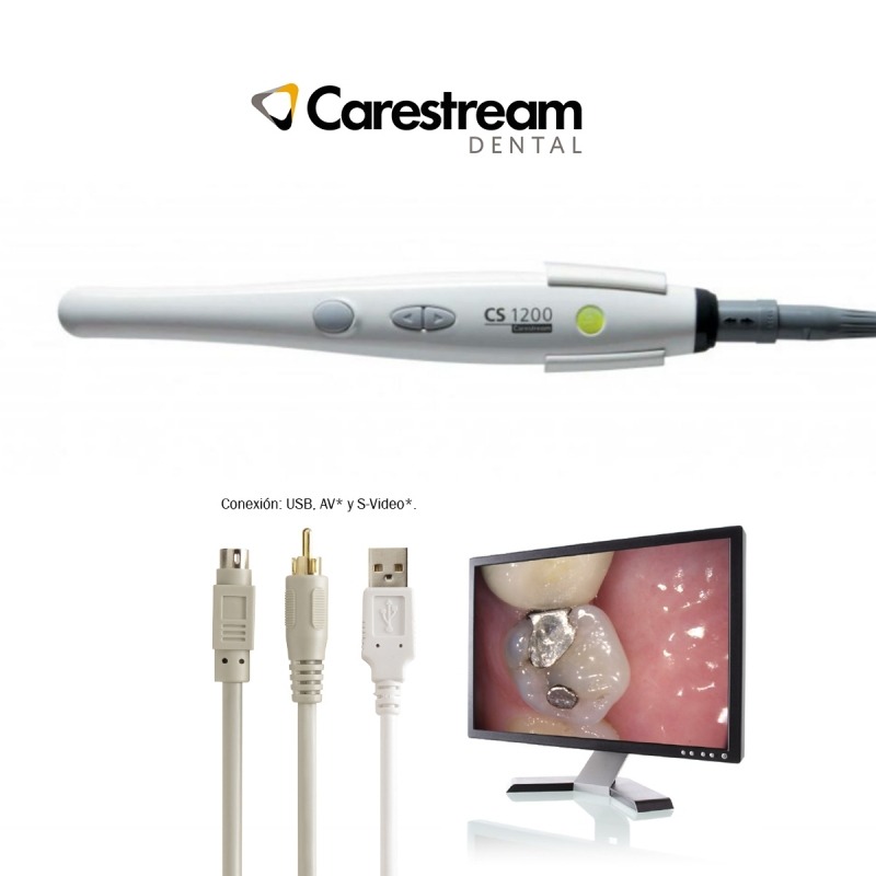 cámara intraoral para apnea del sueño
